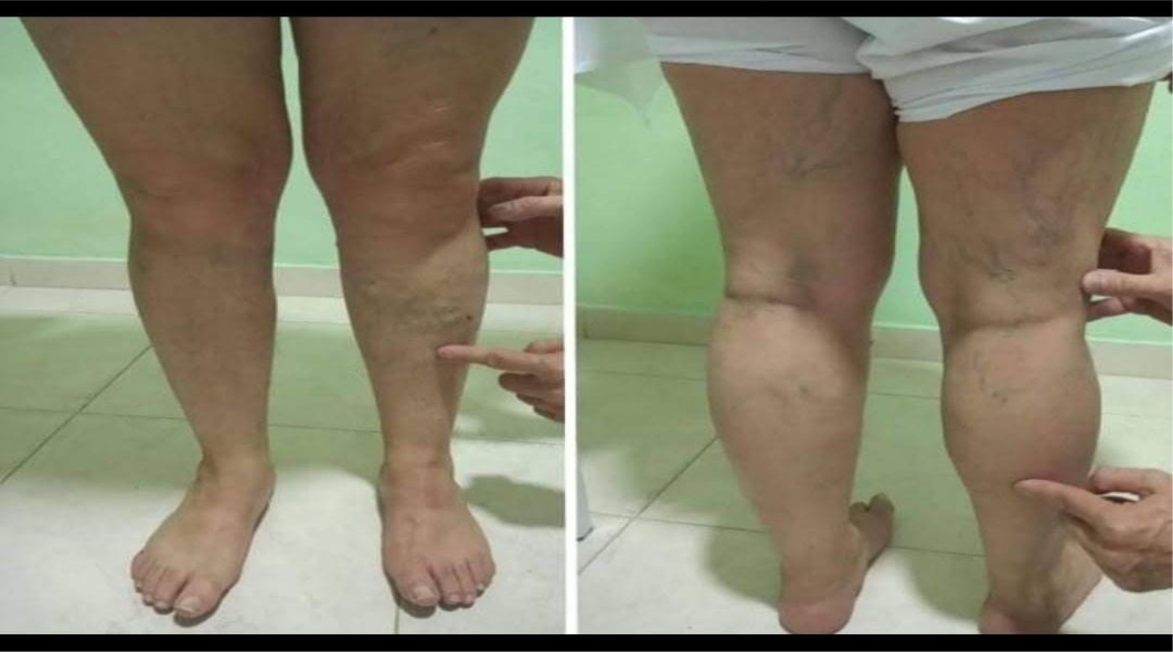 Reynaldo Tobar Bioenergetico 313557 79 62