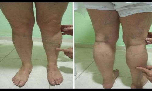 Reynaldo Tobar Bioenergetico 313557 79 62